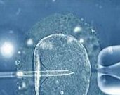 做试管石家庄哪个医院好？石家庄那个医院做试管婴儿好？